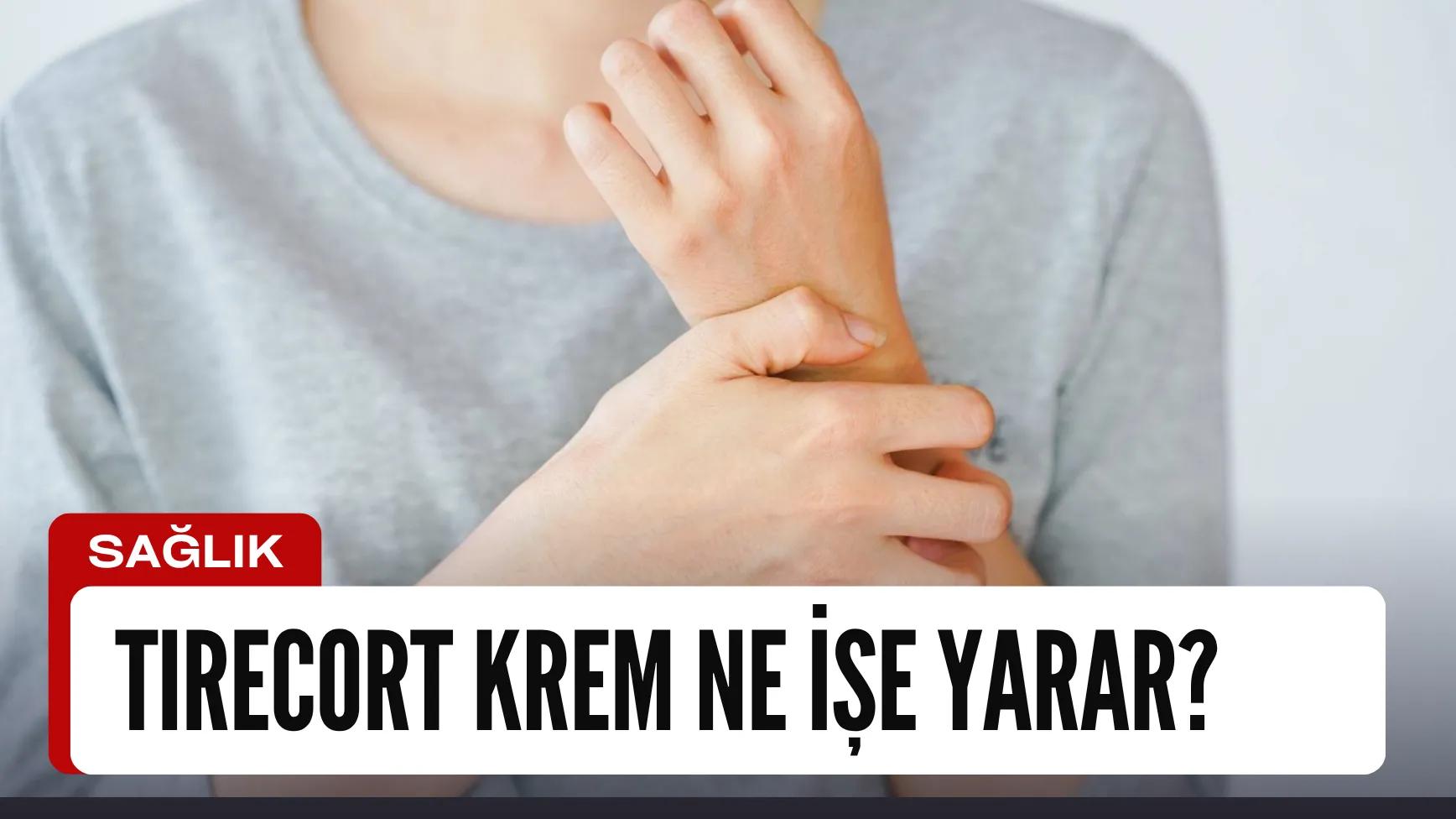 Tirecort Krem Nerelerde Kullanılır? Egzamaya İyi Gelir Mi?
